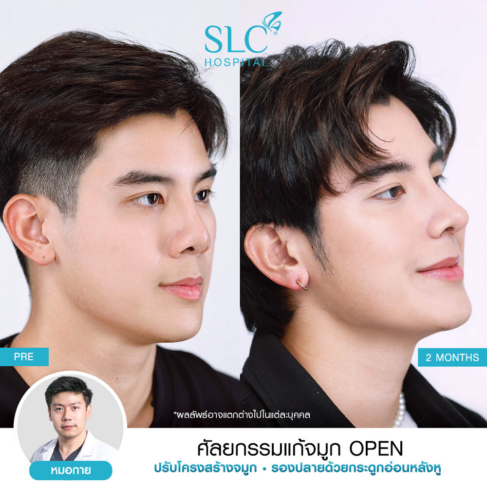 Clinic Results Gallery